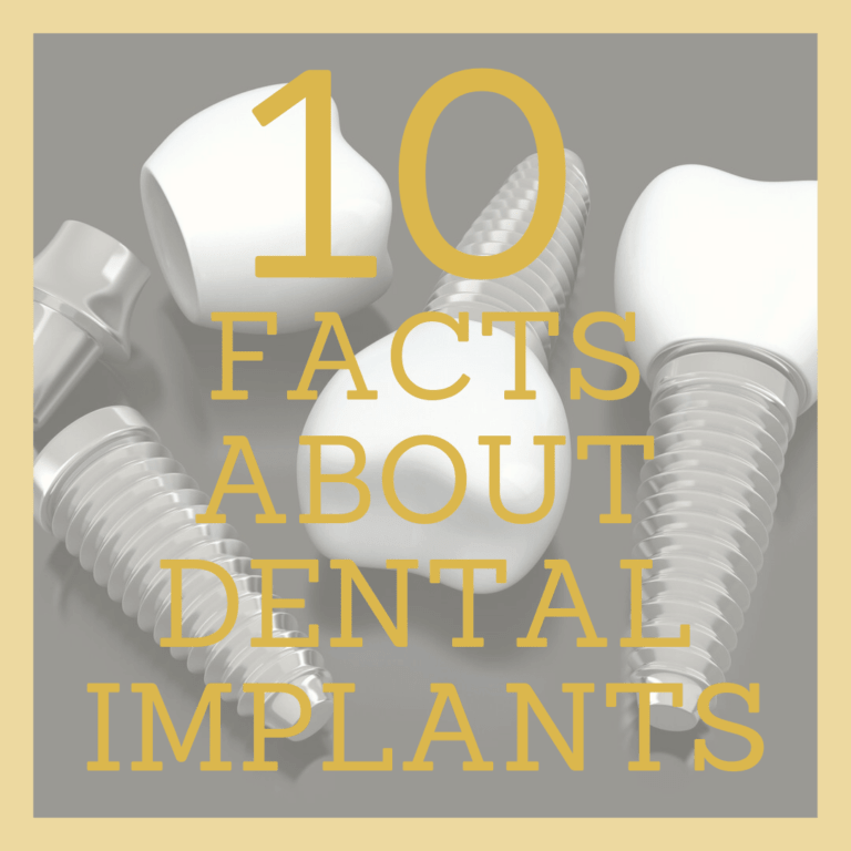 10 Facts About Dental Implants Part I Southwest Family Dentistry