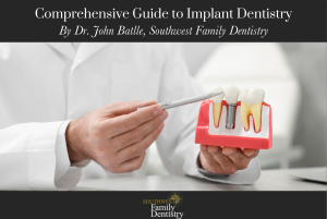 Comprehensive Guide to Implant Dentistry