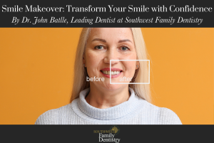 Smile Makeover Transform Your Smile with Confidence
