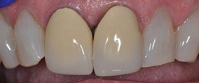 PATIENT BEFORE TREATMENT