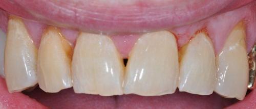 MALE PATIENT BEFORE TREATMENT