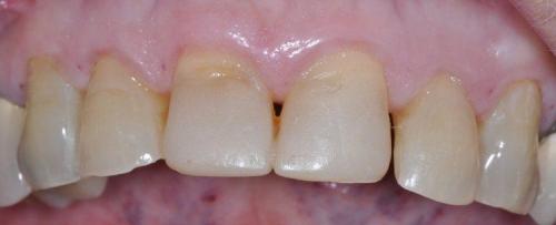 FEMALE PATIENT BEFORE TREATMENT