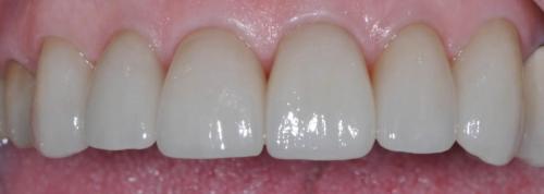 PATIENT AFTER TREATMENT