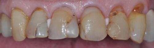 PATIENT BEFORE TREATMENT
