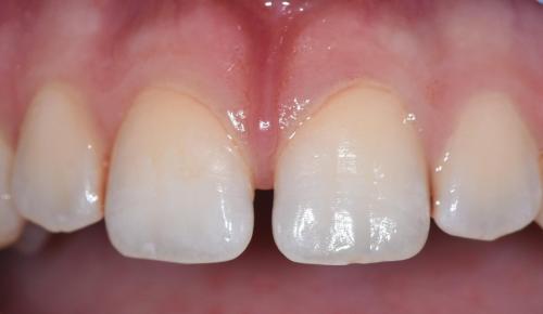 PATIENT BEFORE TREATMENT
