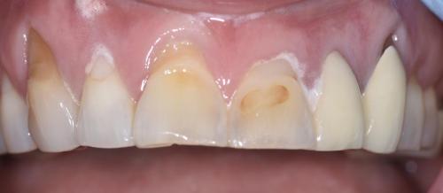 PATIENT BEFORE TREATMENT