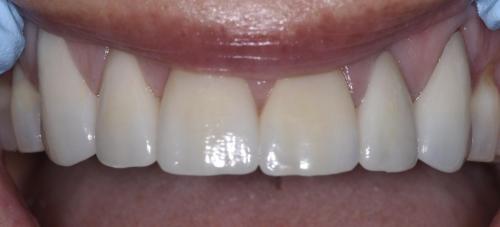 PATIENT AFTER TREATMENT