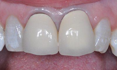 PATIENT BEFORE TREATMENT