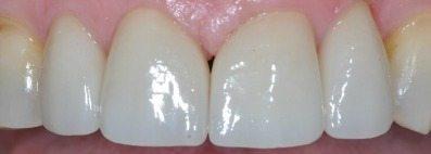 PATIENT AFTER TREATMENT