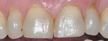 PATIENT BEFORE TREATMENT