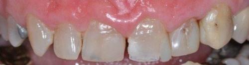 PATIENT BEFORE TREATMENT