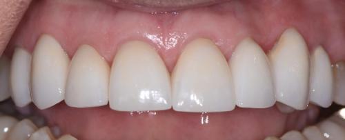 PATIENT AFTER TREATMENT