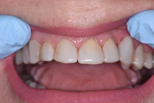 PATIENT BEFORE TREATMENT