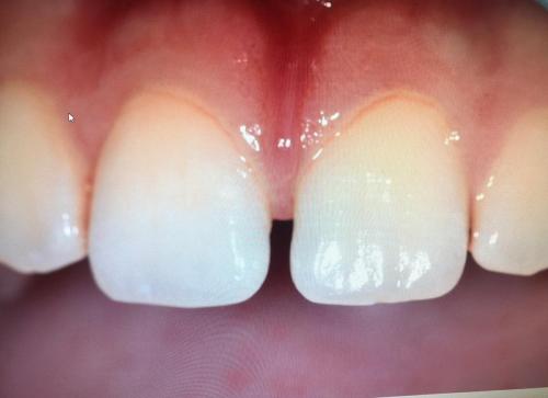 PATIENT BEFORE TREATMENT